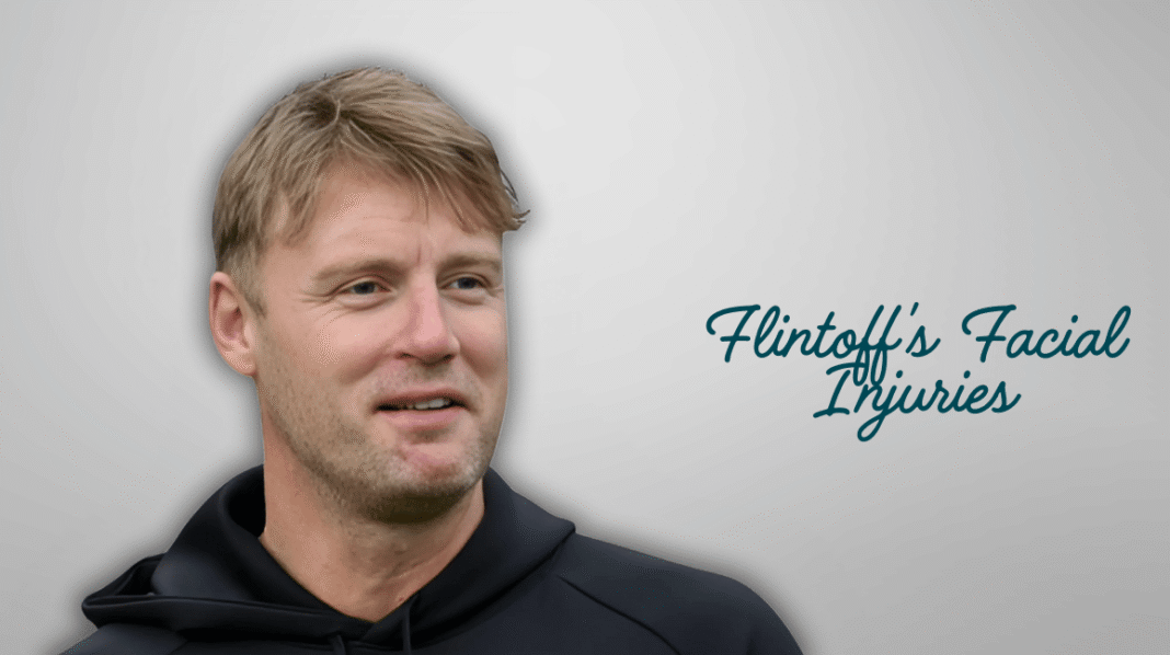 Flintoff's Facial Injuries